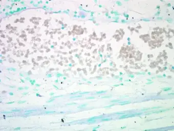 Anti-AKT antibody [N2C2], Internal used in Immunohistochemistry (IHC). GTX121936
